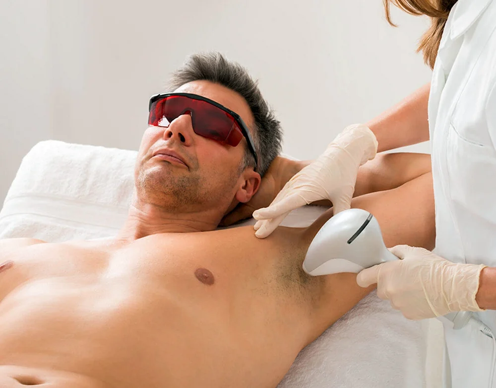 Laser hair removal men