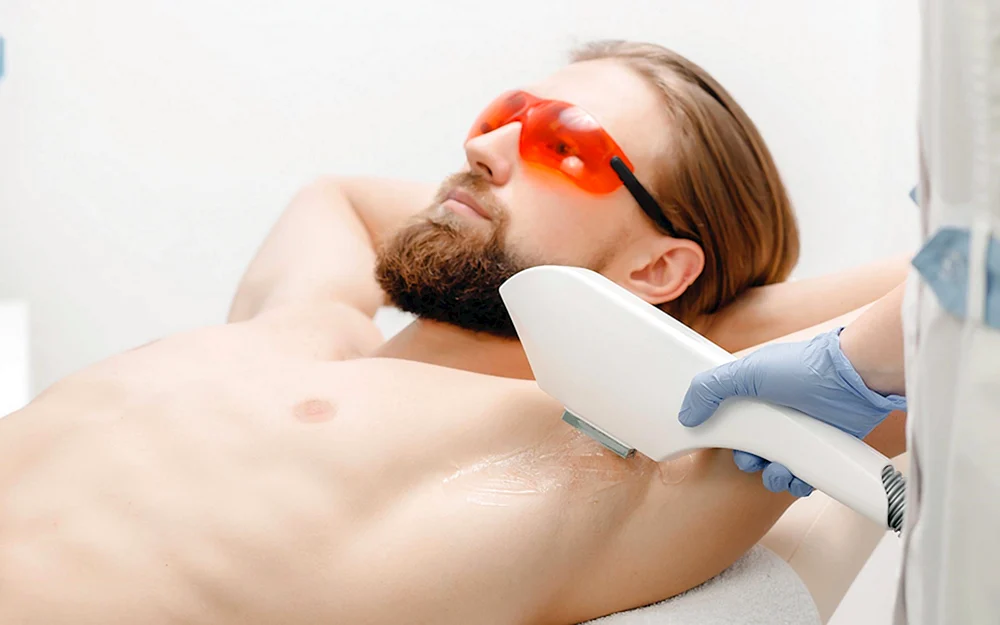 Male Laser hair removal