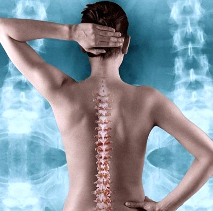 Scoliosis Chiropractic