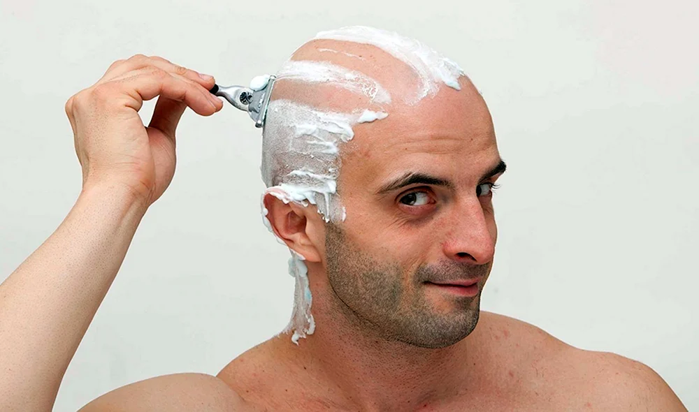 Shaving head