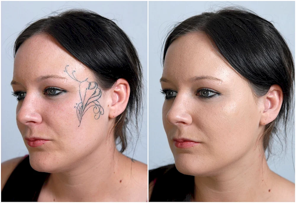 Tattoo concealer Makeup before and after