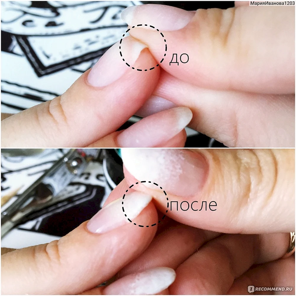 Укрепление акриловой пудрой натуральных ногтей